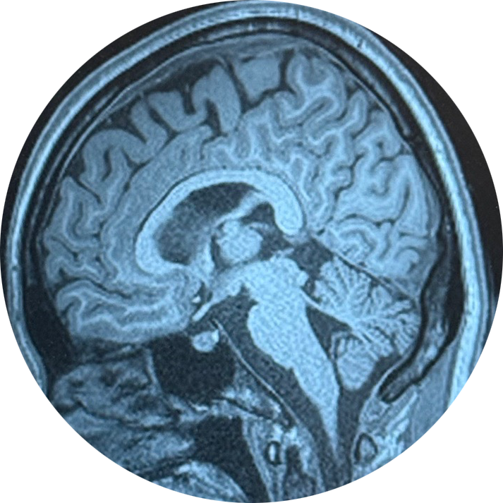 Sagittal brain scan belonging to XSONG